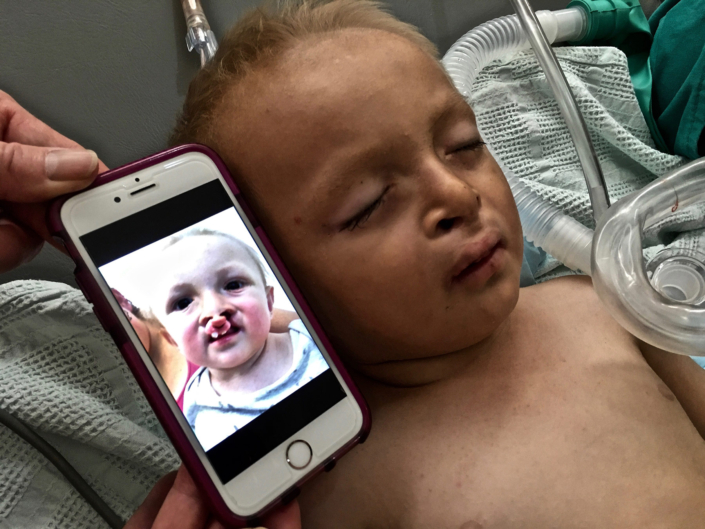 healing-the-children-inca-peru-dental-mission-37