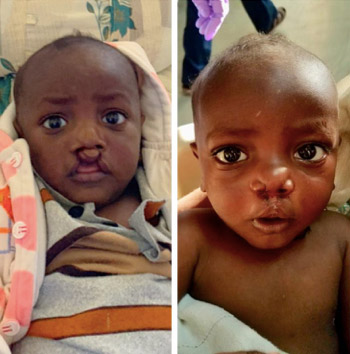 Ethiopia – 2019 Ethiopia - 2019